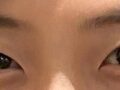 김홍진 원장님 자연유착