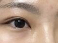 김홍진 원장님 두달 차 후기