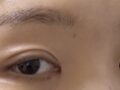 도언록 원장님 후기