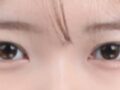 나영수 원장님 시술 후기 입니당
