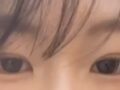 자연유착+윗트임