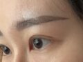 김홍진 원장님께 쌍커풀수술+윗트임 받았어요