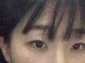 일미리 도언록 원장님 눈재수술 후기