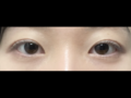 무쌍 쌍수 후기