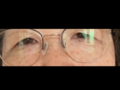 김홍진 원장님 눈수술 2달 후기입니다