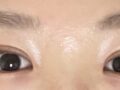 도언록원장님 자연유착 2달차 후기