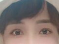 눈 쌍커플 후기