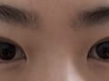 쌍수 후기