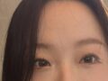 김홍진원장님 자연유착 후기