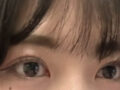 김홍진 원장님 자연유착 후기
