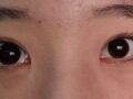 10대 쌍커풀