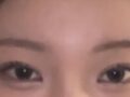 일미리 + 도언록 원장님 +쌍수+윗트임