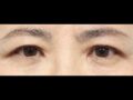 일미리 도언록 원장님 눈썹거상술