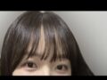 일미리 김홍진원장님 자연유착 후기