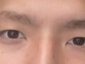 도언록 원장 눈매교정