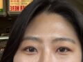 일미리 김홍진 원장님 자연유착