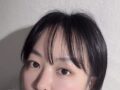 김홍진원장님+자연유착, 윗트임
