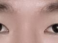 도언록 선생님 / 절개 쌍꺼풀 + 눈매 교정 / 30대 / 남자 / 수술 전, 수술 후 사진 / 3개월 차