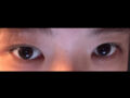 김홍진 선생님 자연유착+윗트임 후기