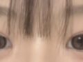 김홍진 원장님 자연유착 후기