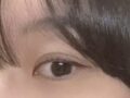 일미리 자연유착 김홍진 원장님