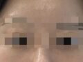 일미리 도언록 원장님 눈밑지 후기
