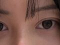都言禄导演的眼部修复手术